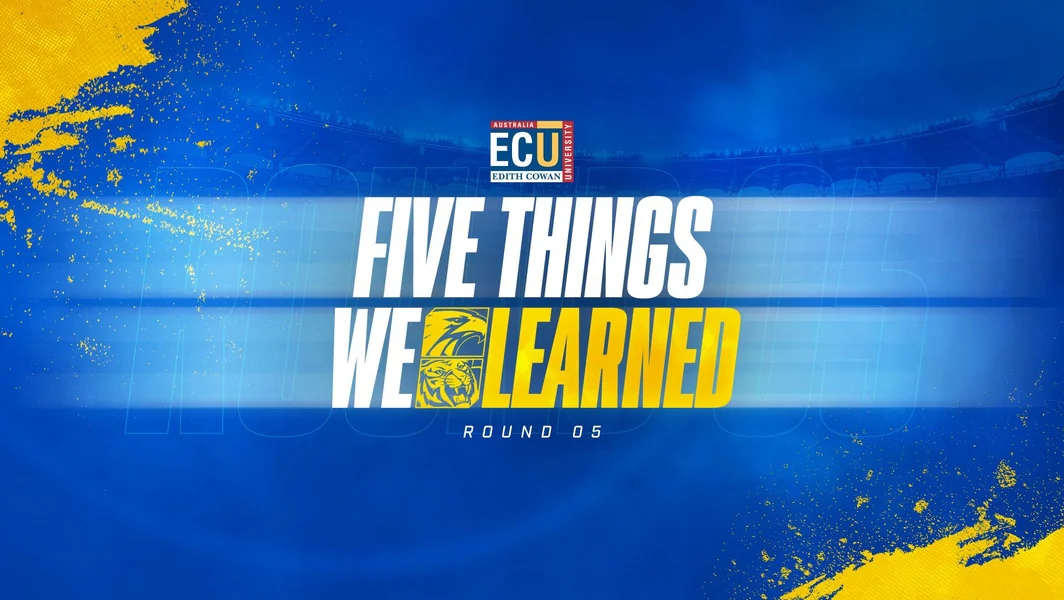 five important insights gained from our game against the Tigers.